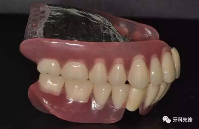 最新活动义齿技术引领牙齿修复新时代