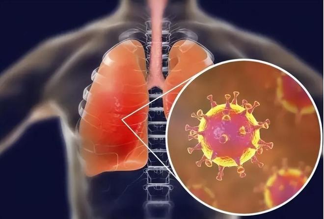 新冠病毒最新症状概述